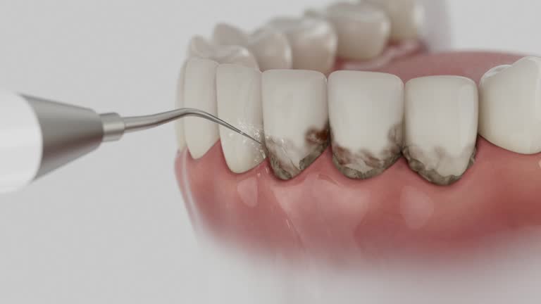 Trusted Tooth Extraction service in Covington, GA - Dentist Open Now